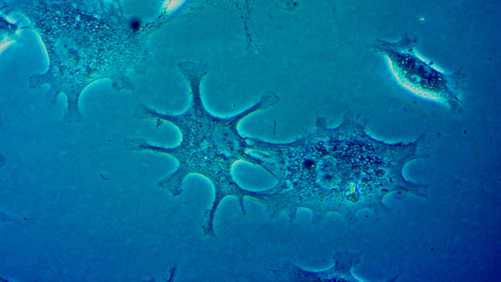 Photo of Astrocyte cells.