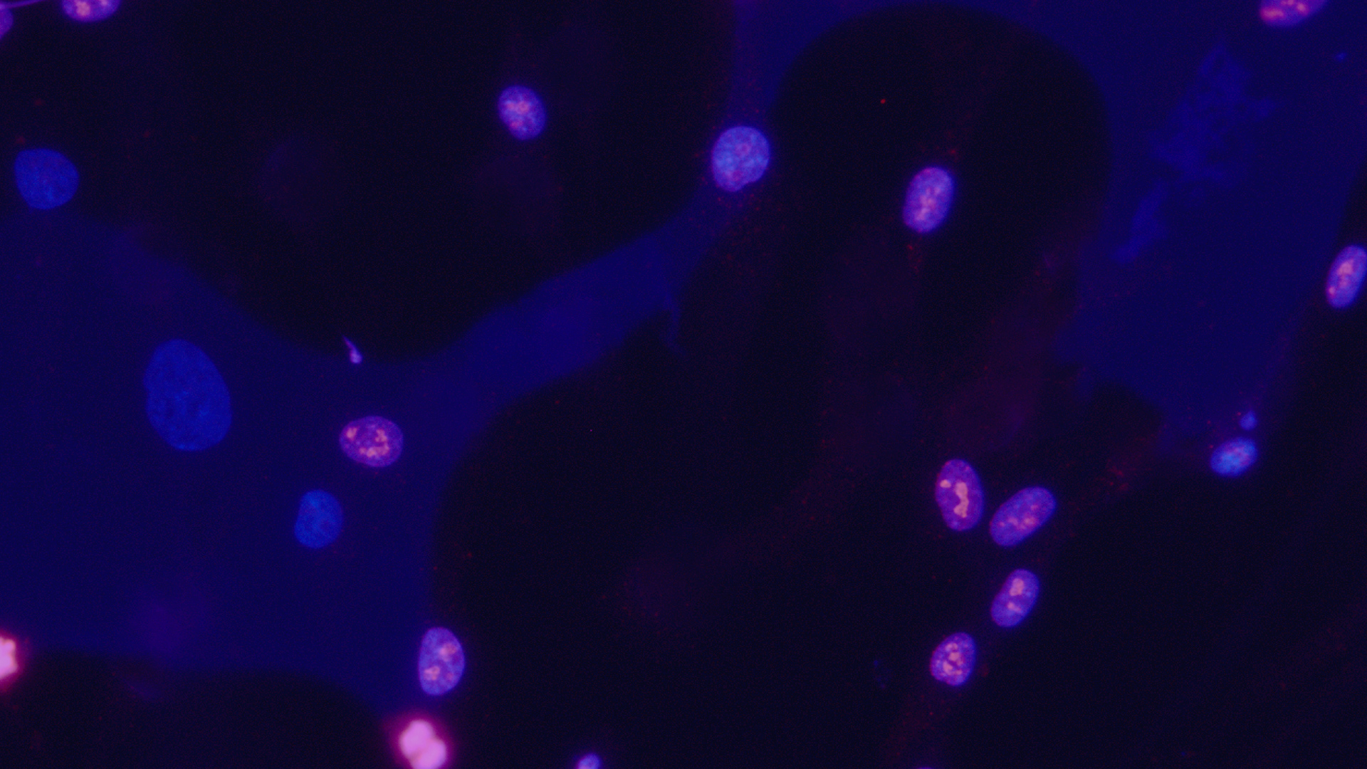 Photo of Fibroblast cells background
