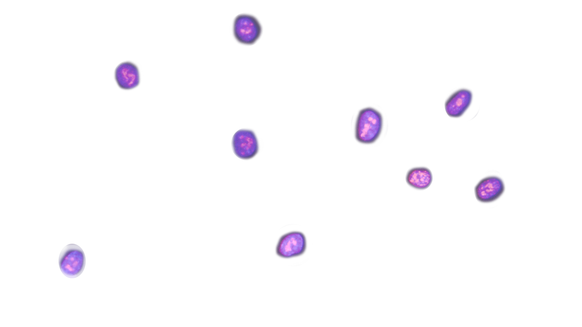 Second overlay image of Fibroblast cells