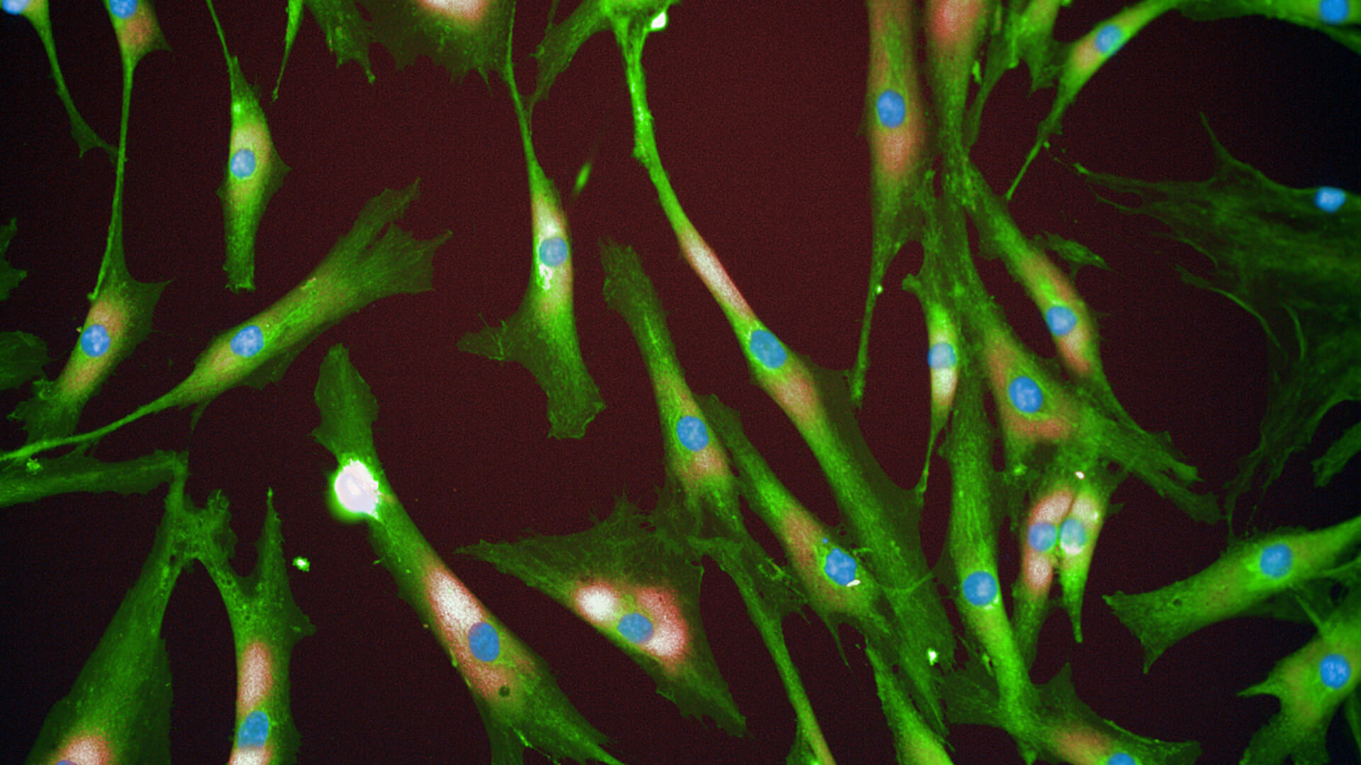 Photo of Fibroblast cells