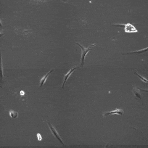 Photo of fibroblast cells
